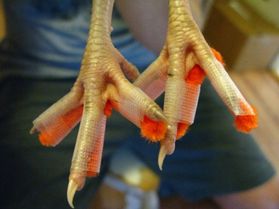 曲がった足指 ～ 指節骨の偏位による足趾の1つまたは複数の弯曲を特徴