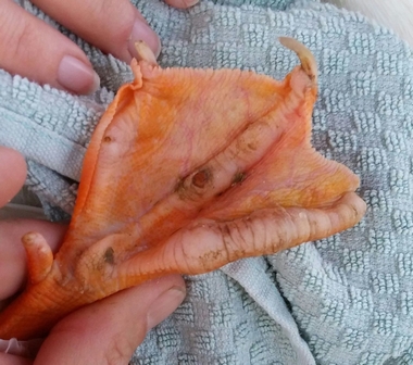 足の爪の怪我 ～ 出血を伴う爪の亀裂や損傷を引き起こします