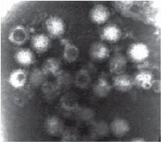 トリレオウイルス(Avian reovirus) ～ ウイルス性関節炎