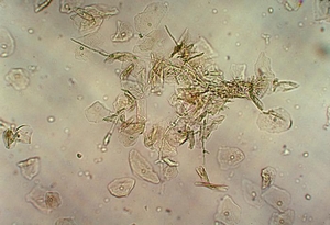 カンジダ・アルビカンス(Candida albicans)