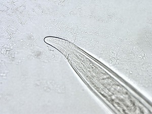 ゴンギロネマ・イングルビコラ(Gongylonema ingluvicola)