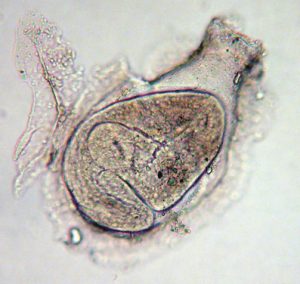 フィロフタルムス・グラリ(Philophthalmus gralli) ～ 眼吸虫感染症