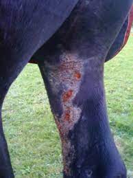 潰瘍性リンパ管炎(Ulcerative Lymphangitis)