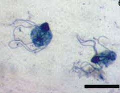 ヘキサミタ症（症状・予防）