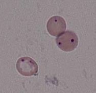 ピロプラズマ症（症状・予防）