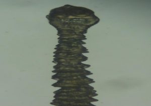 漏斗状条虫(Choanotaenia infundibulum) ～ 条虫症