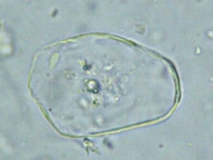 シチメンチョウヘキサミタ(Spironucleus meleagridis)