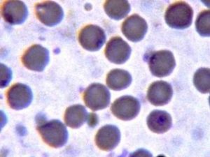 Babesia motasi