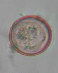 アイメリア・パルバ